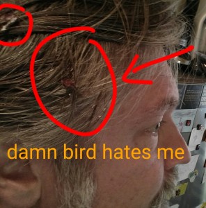 image of bird poop in hair