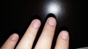 Interestingly, in June I happened to glance at my fingernails and realized that the chemotherapy had actually cleared them up. For as long as I could remember, my nails had been "cloudy" -- now, they might be a bit more brittle and weak, but dang those nails are clear!